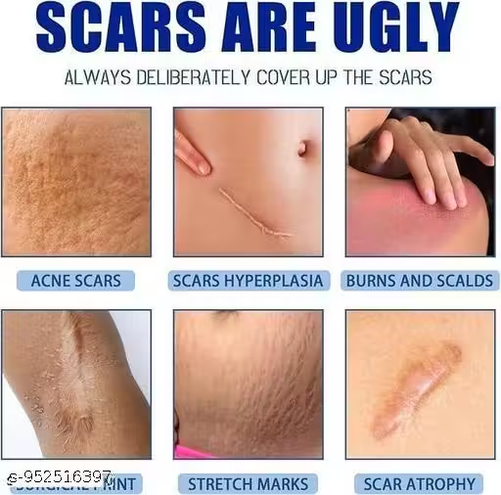 Scar Removal Cream & Gel | Advanced Scar Treatment for Old & New Scars, Keloids & Stretch Marks | Fast-Absorbing Scar Repair Gel for Face & Body